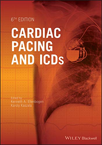 Cardiac Pacing and ICDs - Ellenbogen